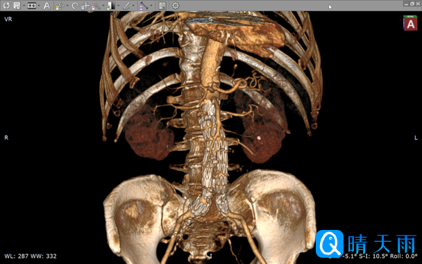 20260103104728097979